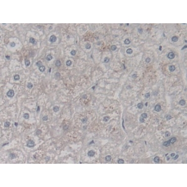 V-Ral Simian Leukemia Viral Oncogene Homolog A (RALA) Human Monoclonal Antibody