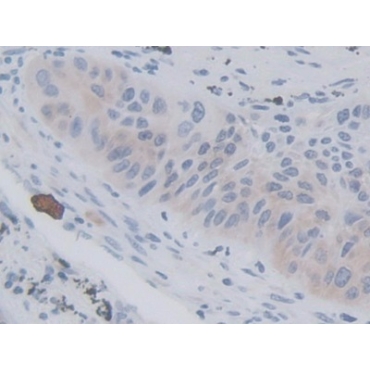 V-Ral Simian Leukemia Viral Oncogene Homolog A (RALA) Human Monoclonal Antibody