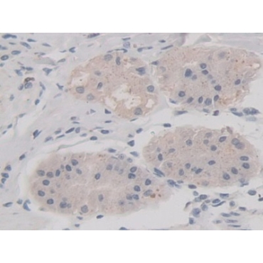 V-Ral Simian Leukemia Viral Oncogene Homolog A (RALA) Human Monoclonal Antibody