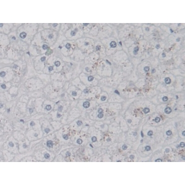 V-Ral Simian Leukemia Viral Oncogene Homolog A (RALA) Human Monoclonal Antibody
