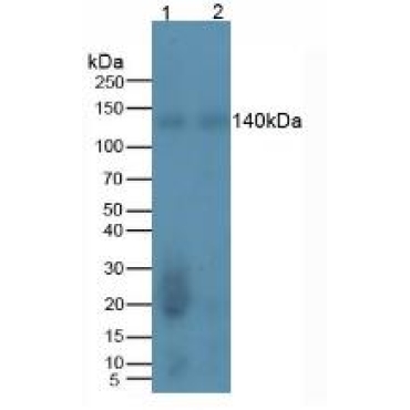 REV1 Homolog (REV1) Human Monoclonal Antibody