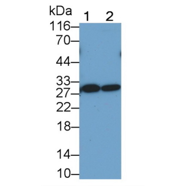 T-Cell Immunoreceptor With Ig And ITIM Domains Protein (TIGIT) Human Monoclonal Antibody