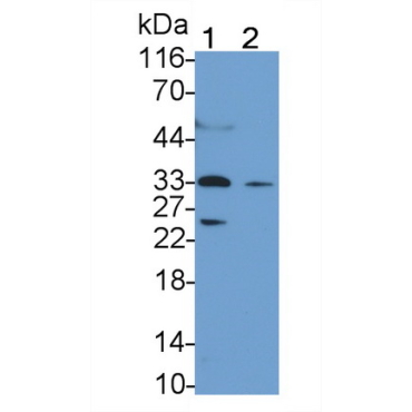T-Cell Immunoreceptor With Ig And ITIM Domains Protein (TIGIT) Human Monoclonal Antibody