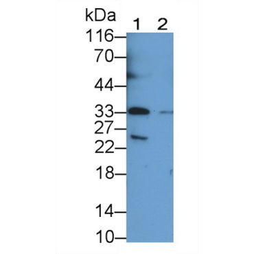 T-Cell Immunoreceptor With Ig And ITIM Domains Protein (TIGIT) Human Monoclonal Antibody