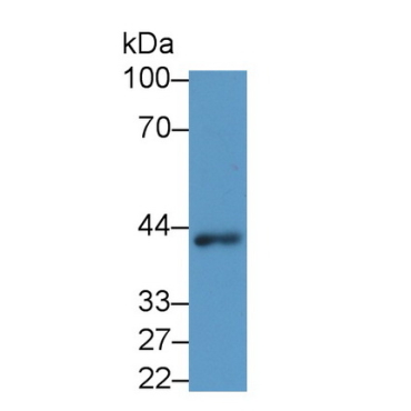 Wingless Type MMTV Integration Site Family, Member 3A (WNT3A) Human Monoclonal Antibody