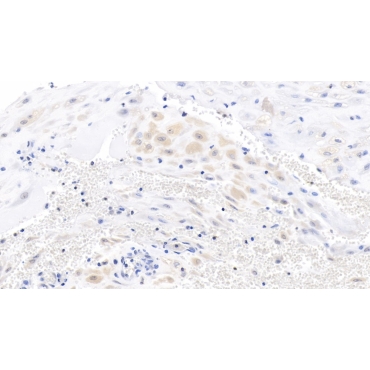 Wingless Type MMTV Integration Site Family, Member 3A (WNT3A) Human Monoclonal Antibody