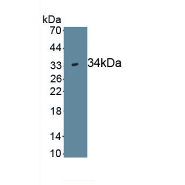 Wingless Type MMTV Integration Site Family, Member 7B (WNT7B) Human Monoclonal Antibody