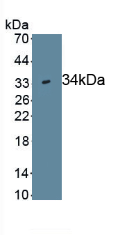 Wingless Type MMTV Integration Site Family, Member 7B (WNT7B) Human Monoclonal Antibody