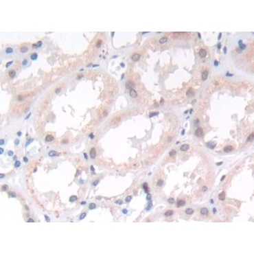 Suppression Of Tumorigenicity 14 (ST14) Human Monoclonal Antibody