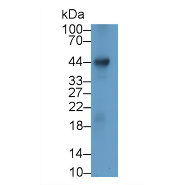 Rh Blood Group, D Antigen (RHD) Human Monoclonal Antibody