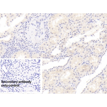 Rh Blood Group, D Antigen (RHD) Human Monoclonal Antibody