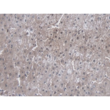 Cytochrome P450 3A7 (CYP3A7) Human Monoclonal Antibody