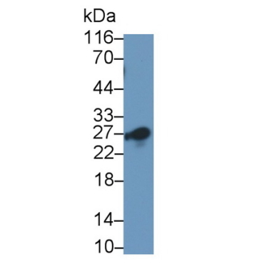 Cluster Of Differentiation 8b (CD8b) Human Monoclonal Antibody