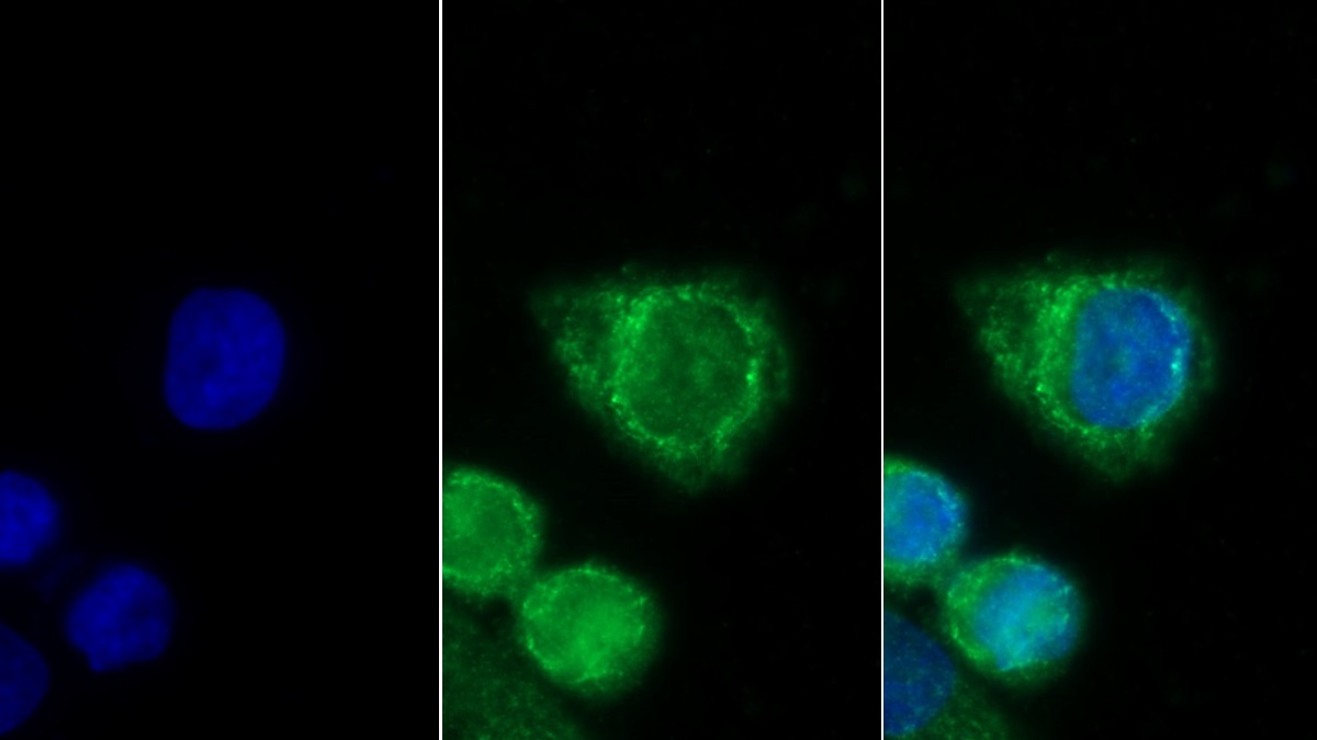 Glioblastoma Expressed Ring Finger Protein (GERP) Rat Monoclonal Antibody