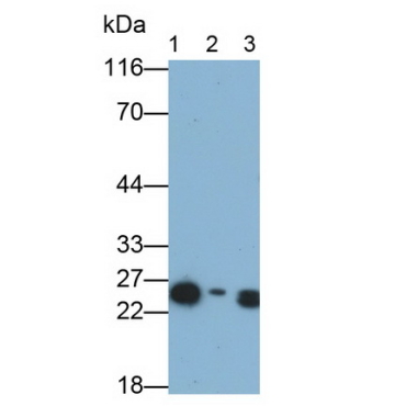 Ependymin Related Protein 1 (EPDR1) Human Monoclonal Antibody