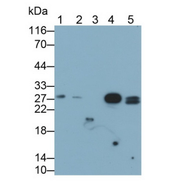 Ependymin Related Protein 1 (EPDR1) Human Monoclonal Antibody