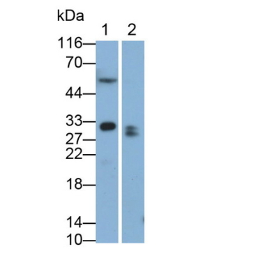 Ependymin Related Protein 1 (EPDR1) Human Monoclonal Antibody