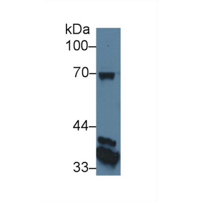 CUB And Zona Pellucida Like Domains Protein 1 (CUZD1) Human Monoclonal Antibody