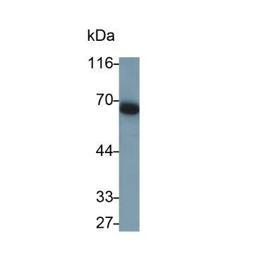 CUB And Zona Pellucida Like Domains Protein 1 (CUZD1) Human Monoclonal Antibody