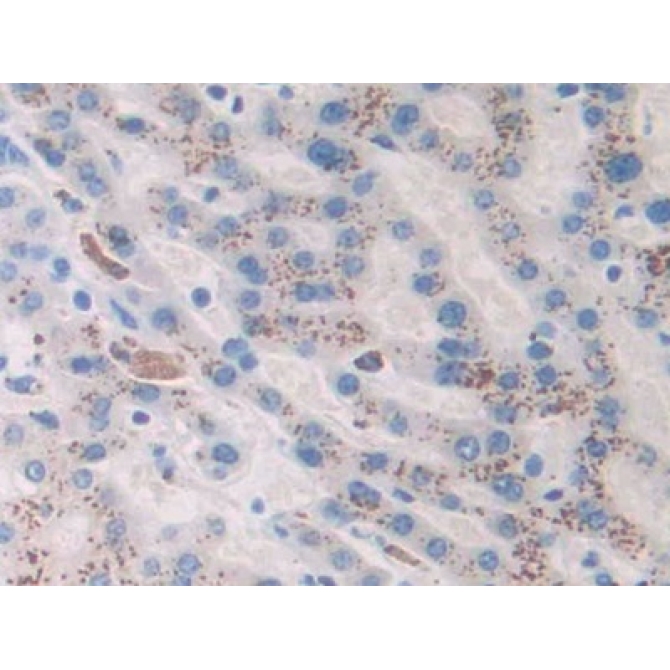 Angiotensin 1-7 (Ang1-7) Human Monoclonal Antibody