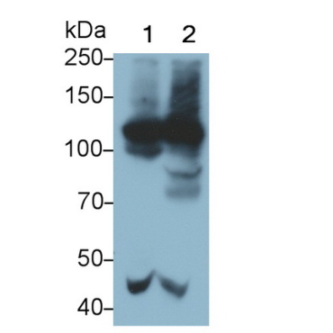 Complement Component 4d (C4d) Human Monoclonal Antibody