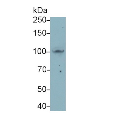 Complement Component 4d (C4d) Human Monoclonal Antibody