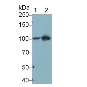 Complement Component 4d (C4d) Human Monoclonal Antibody