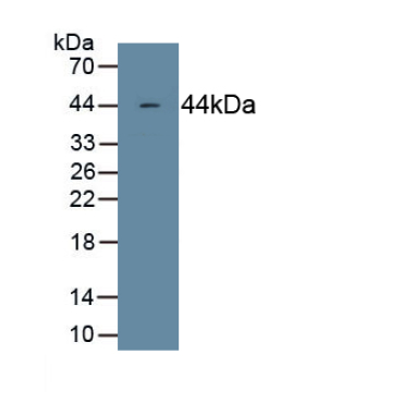 Complement Component 4c (C4c) Human Monoclonal Antibody
