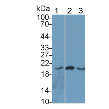 Angiopoietin Like Protein 8 (ANGPTL8) Human Monoclonal Antibody