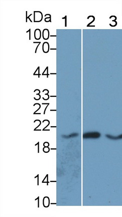 Angiopoietin Like Protein 8 (ANGPTL8) Human Monoclonal Antibody