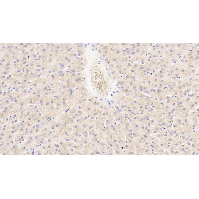 Angiopoietin Like Protein 8 (ANGPTL8) Human Monoclonal Antibody