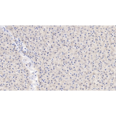 Angiopoietin Like Protein 8 (ANGPTL8) Human Monoclonal Antibody
