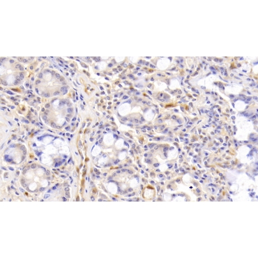 Activin A (ACVA) Human Polyclonal Antibody