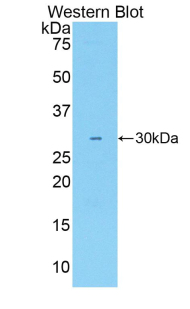 Activated Leukocyte Cell Adhesion Molecule (ALCAM) Rabbit Polyclonal Antibody