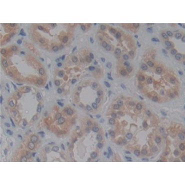 Angiotensin I Converting Enzyme (ACE) Human Polyclonal Antibody