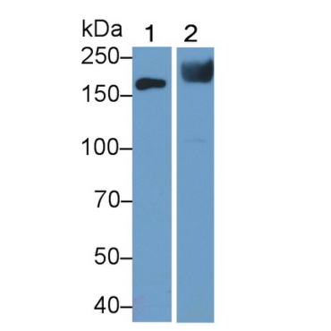 Angiotensin I Converting Enzyme (ACE) Mouse Polyclonal Antibody