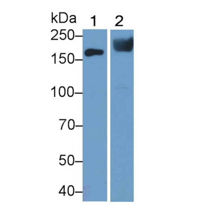 Angiotensin I Converting Enzyme (ACE) Mouse Polyclonal Antibody