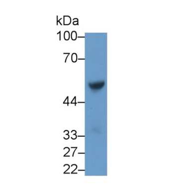 Angiotensin II (AngII) Human Polyclonal Antibody