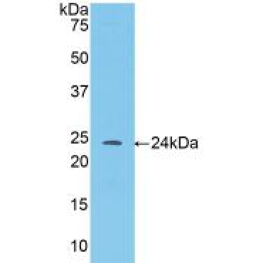 Angiopoietin 1 (ANGPT1) Mouse Polyclonal Antibody