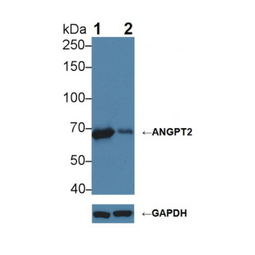 Angiopoietin 2 (ANGPT2) Human Polyclonal Antibody