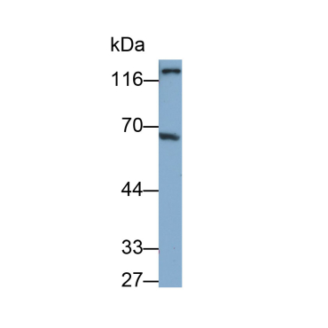 Angiopoietin 2 (ANGPT2) Mouse Polyclonal Antibody