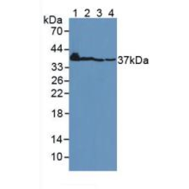 Connective Tissue Growth Factor (CTGF) Human Polyclonal Antibody