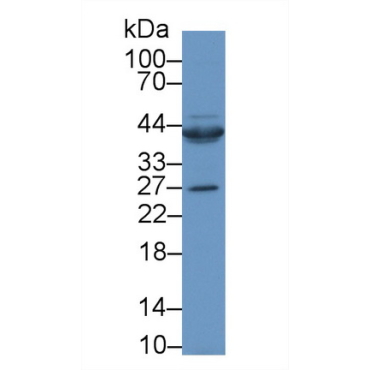 Connective Tissue Growth Factor (CTGF) Human Polyclonal Antibody