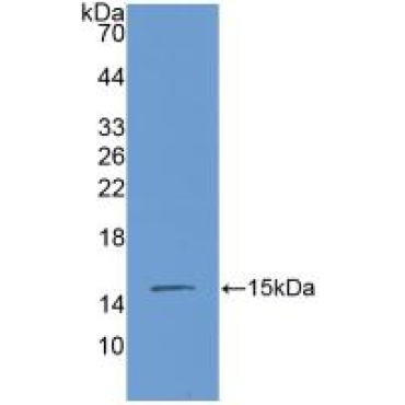 Connective Tissue Growth Factor (CTGF) Mouse Polyclonal Antibody