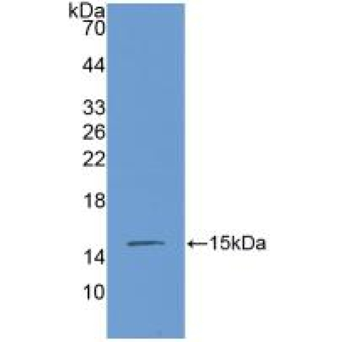 Connective Tissue Growth Factor (CTGF) Mouse Polyclonal Antibody
