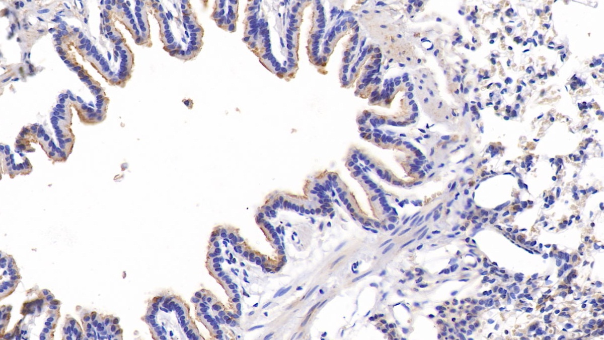 Connective Tissue Growth Factor (CTGF) Rat Polyclonal Antibody