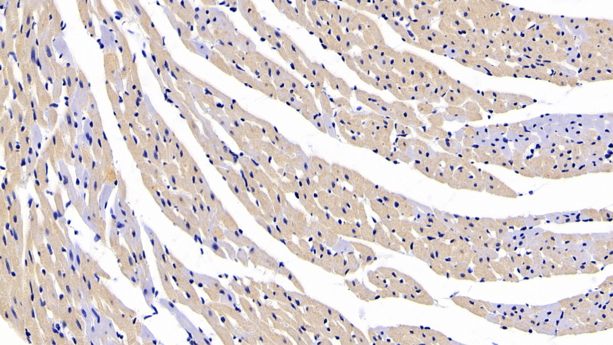 Connective Tissue Growth Factor (CTGF) Rabbit Polyclonal Antibody