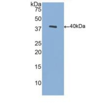 Brain Derived Neurotrophic Factor (BDNF) Human Polyclonal Antibody
