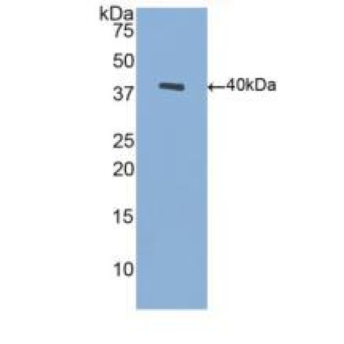 Brain Derived Neurotrophic Factor (BDNF) Human Polyclonal Antibody