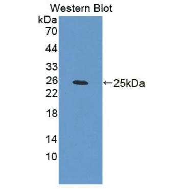 Brain Derived Neurotrophic Factor (BDNF) Human Polyclonal Antibody